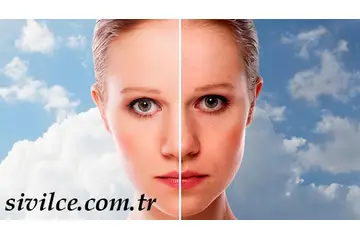 Cilt Lekeleri Belirtileri ve Tedavisi