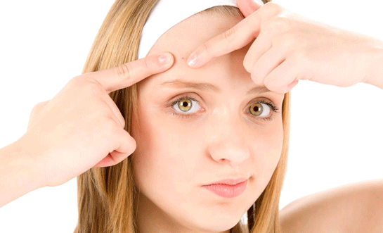 Evde Sivilce Tedavisi Nasıl Yapılır?