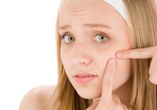 Sivilce Lekeleri İçin Maske